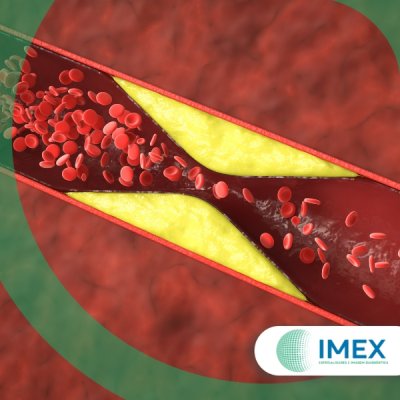 Exame de Colesterol em Guarulhos