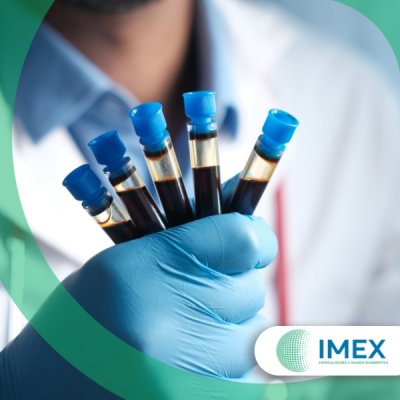 Exame de Triglicérides em Guarulhos