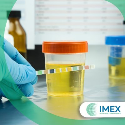 Exame de Urina em Guarulhos