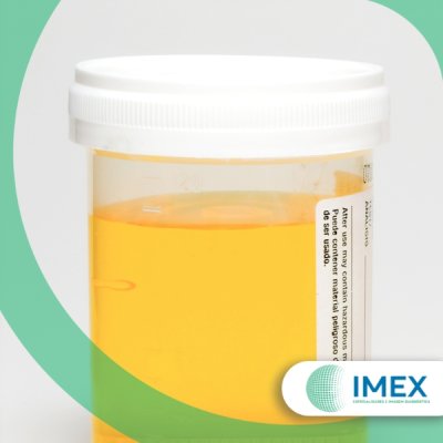 Exame de Urocultura em Guarulhos