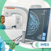 Mamografia em Santa Isabel